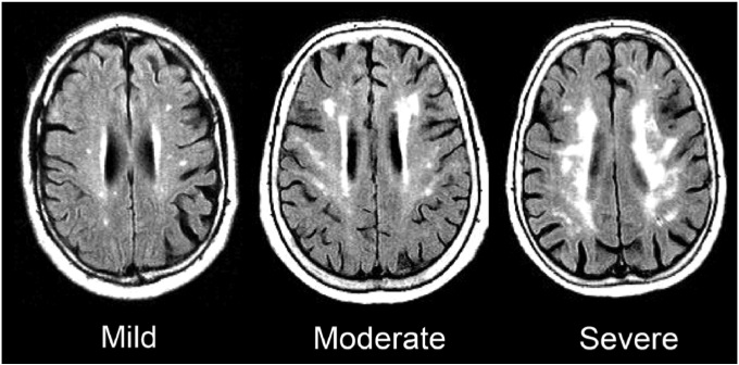 Namoro escondido mauricio e mauri