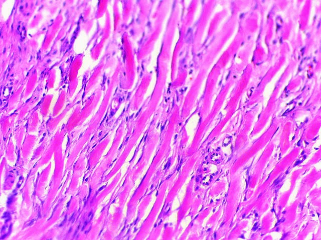 Obat Keloid Obat Keloid