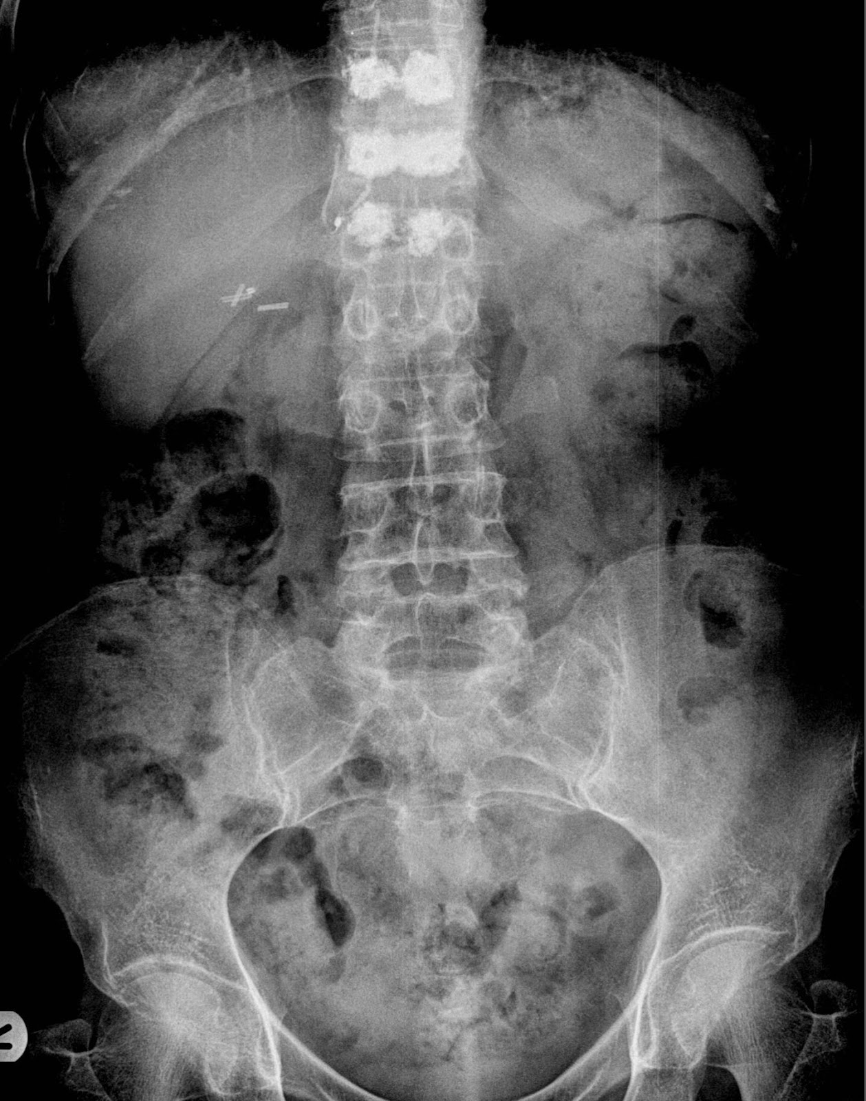 the xray doctor: xrayoftheweek 19: can you spot the problem?