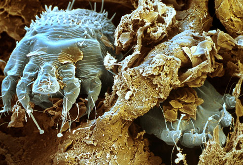 scabies spread