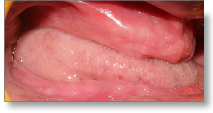 Complete dentures steps pdf