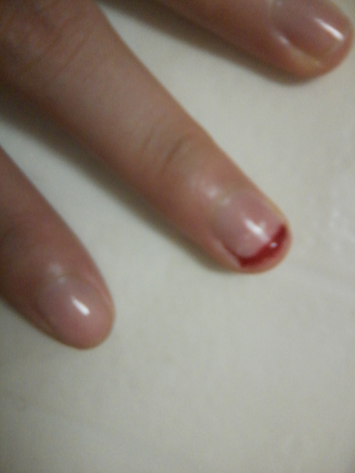 Dragon.Fly Torn my Nail!! OMG Blood!. + first aid care