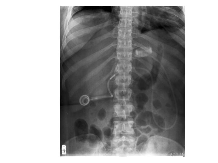 HEALTH FROM TRUSTED SOURCES Bariatric surgery