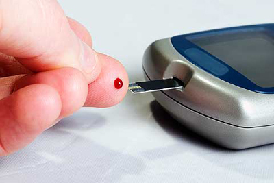 Diabetes Mellitus Ii