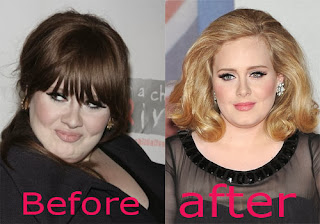 Adele Nose Job Before and After Photo