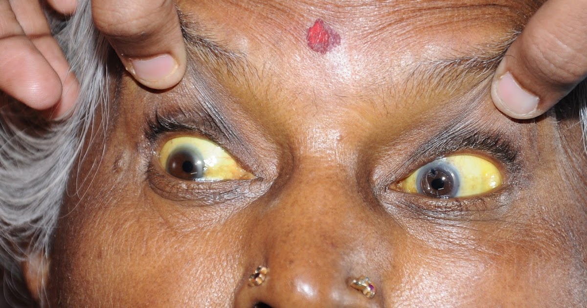 General Surgery Clinics A Surgeon's Blog Differential Diagnosis of