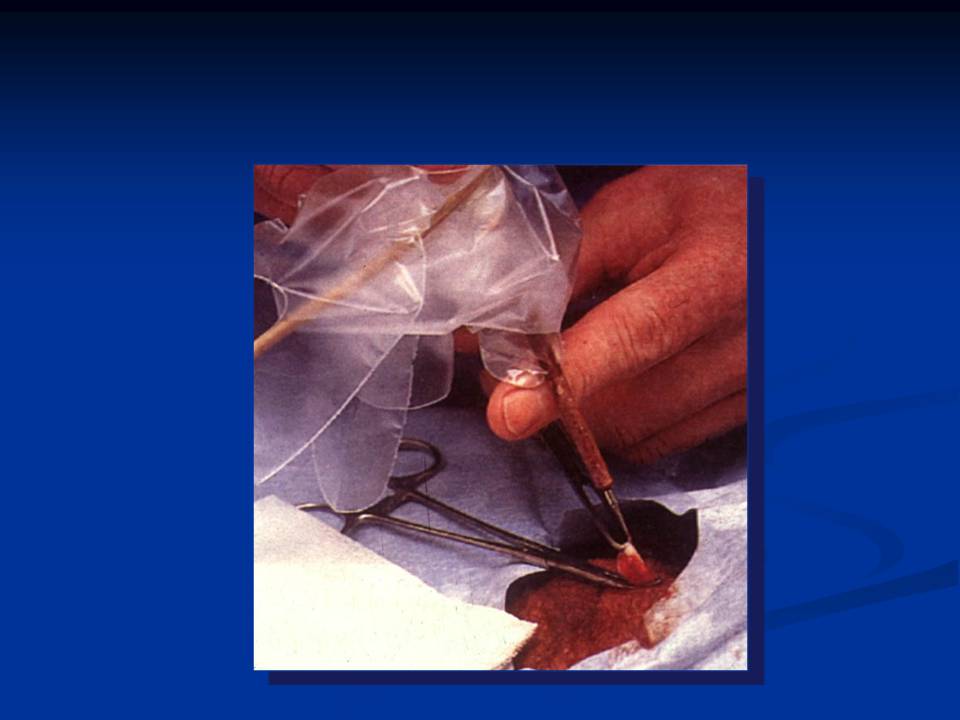 مكافحة عدوى وتلوث المستشفيات غرف العمليات ومكافحة العدوى