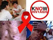 Ciri-Ciri Terjangkit HIV/Aids dan Penyebabnya