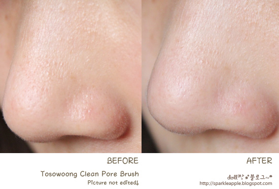 How To Clean Facial Pores 116