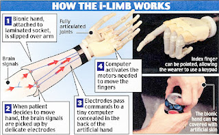 diagram showing how the i-limb works