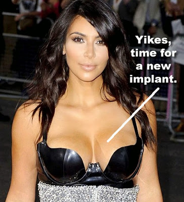 Kim Kardashian breast implant obvious