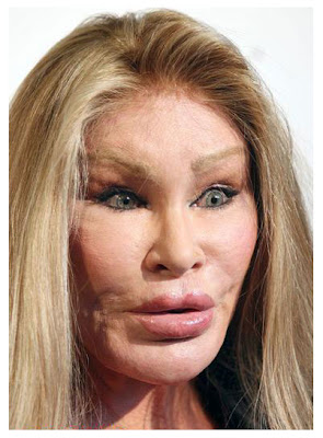 Looks like she had many Facial plastic surgeries lips enhancement, cheeks surgery, eye surgery , eyebrow enhancement and other facial improvement cosmetic surgery.