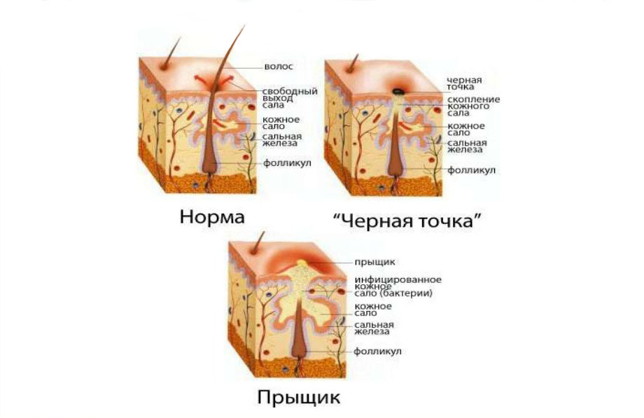 Что выделяют поры кожи Что выделяют поры кожи