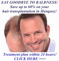 Hair transplantation in Hungary