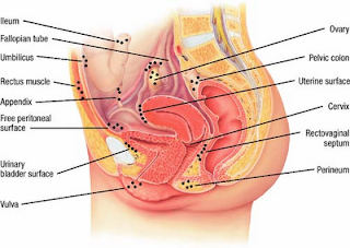 The T: November 2012 menstrual pain diagram 