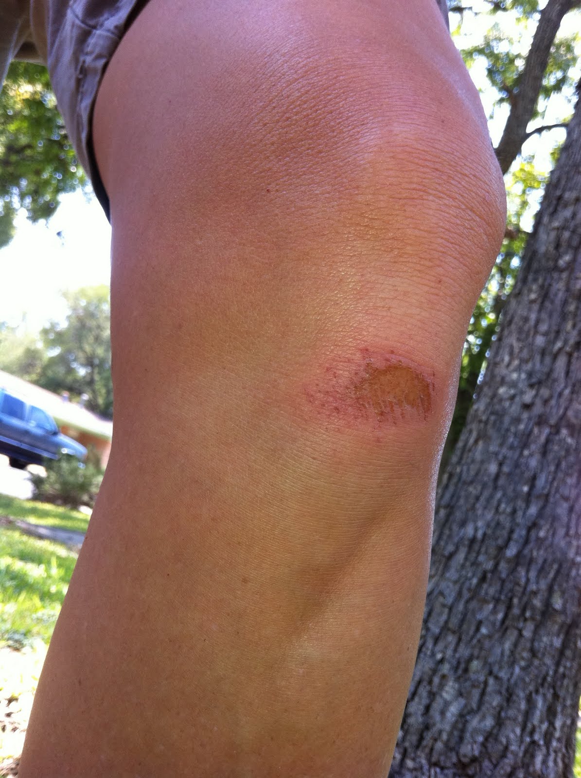 Ballotable Records Cuts and Scrapes