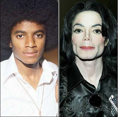 michael jackson antes y despues de sus operaciones michael jackson antes y despues de sus operaciones