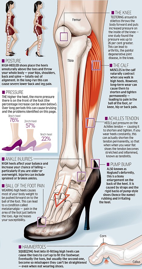 Footwear Hip And Heel Pain Wearing Heels Foot Pain From Not