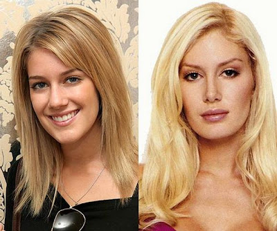 Jessica Simpson Plastic Surgery