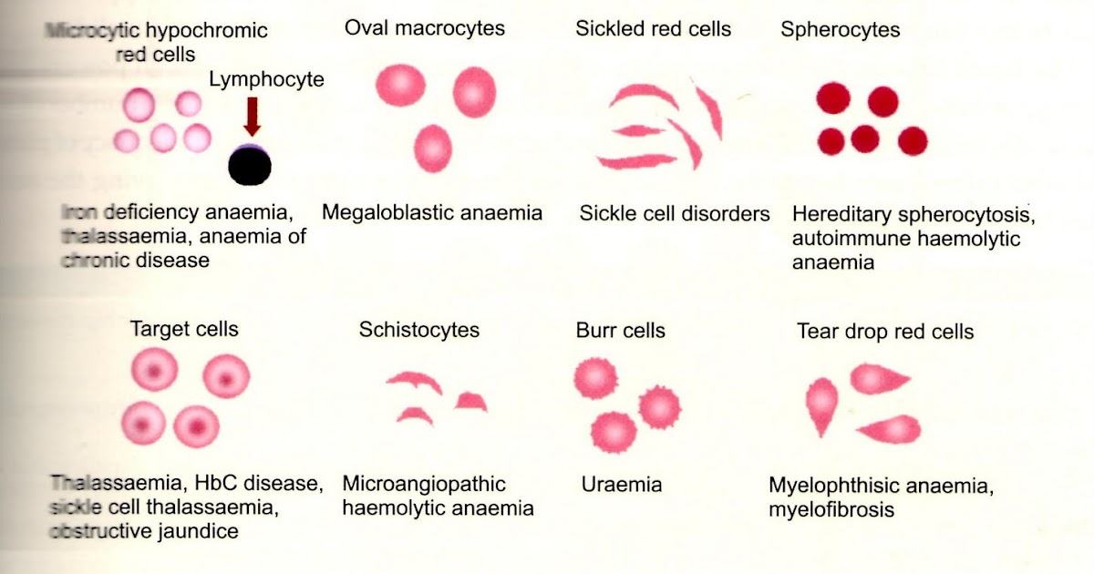 BLOOD ABNORMALITIES OF RED BLOOD CELLS