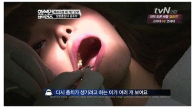 韓國 糖醬妹 滿嘴蛀牙照吃