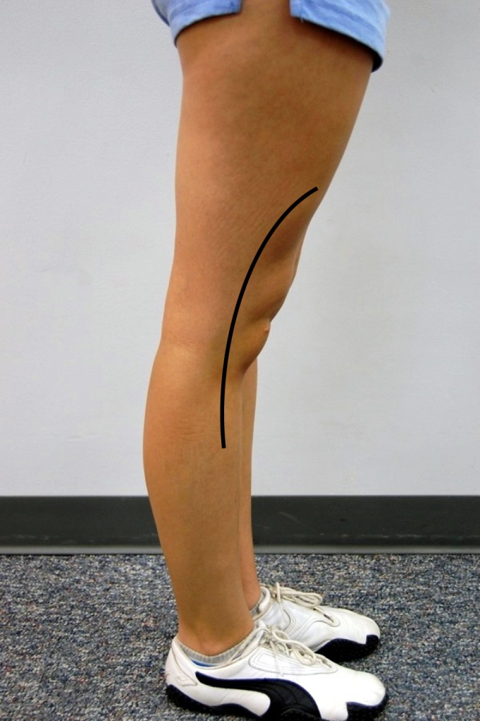 Brett Richmond Injury Prevention in Netball