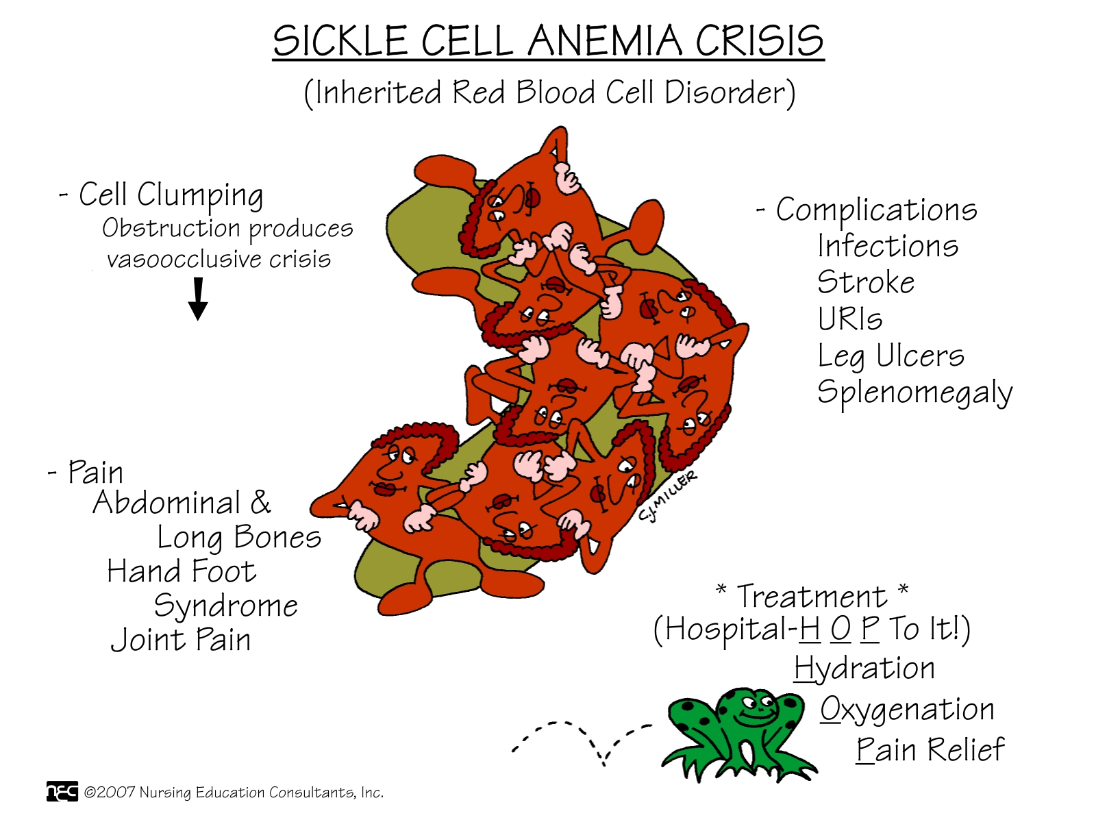sickle cell disease | national heart, lung, and blood institute (nhlbi)