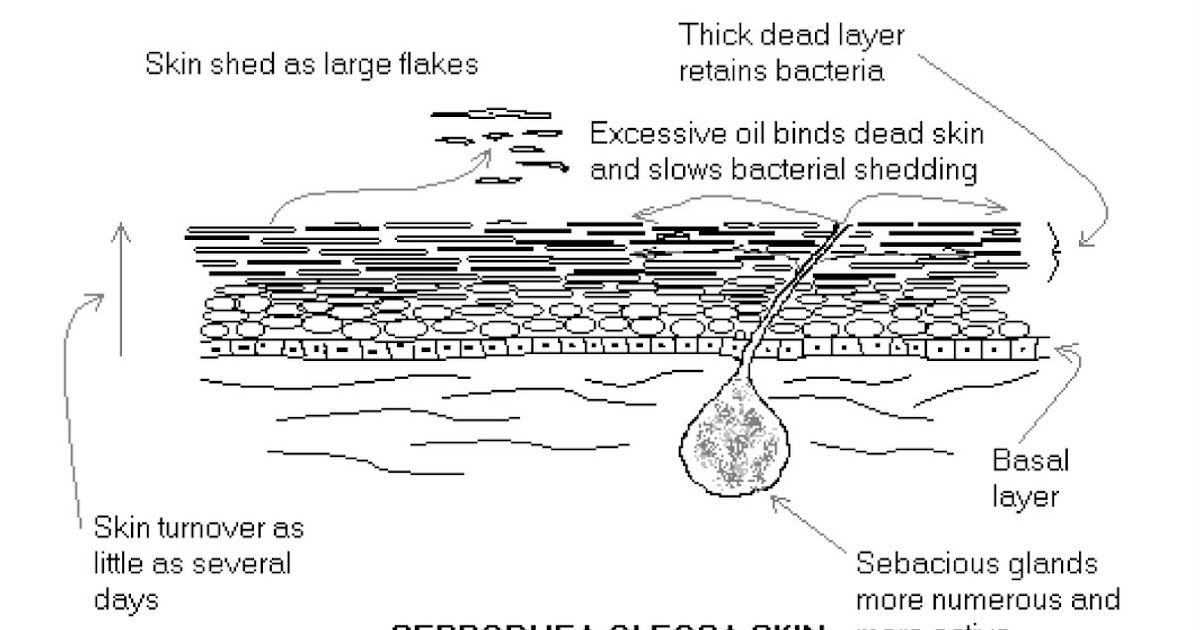 Seborrheic Dermatitis In Dogs Uk Seborrheic Dermatitis In Dogs Uk