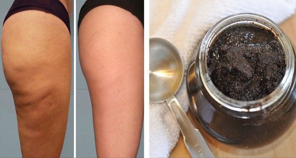2 Ingredients Anti-Cellulite Paste! The Magic Cellulite Eraser! 2 Ingredients Anti-Cellulite Paste! The Magic Cellulite Eraser!