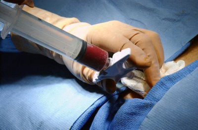 DE CITOGENETICA DE LEUCEMIA MIELOIDE de citogenetica de leucemia mieloide: