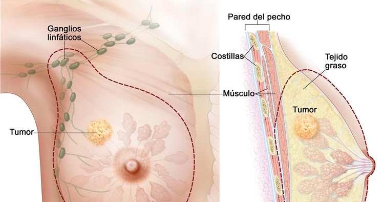 Hypothyroidism pequeno peito