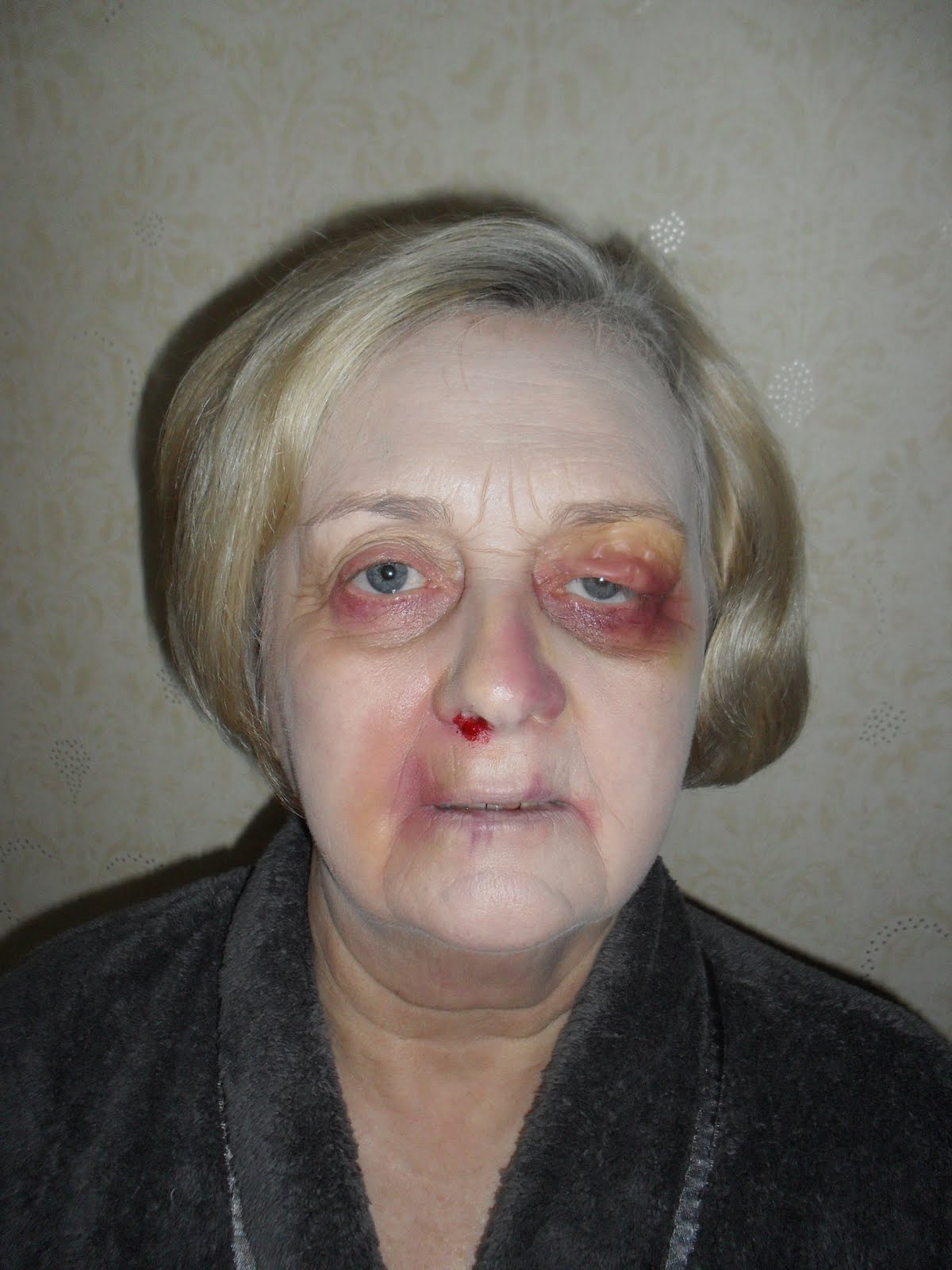 Jessica Elizabeth Guthrie: Bruised & Beaten.