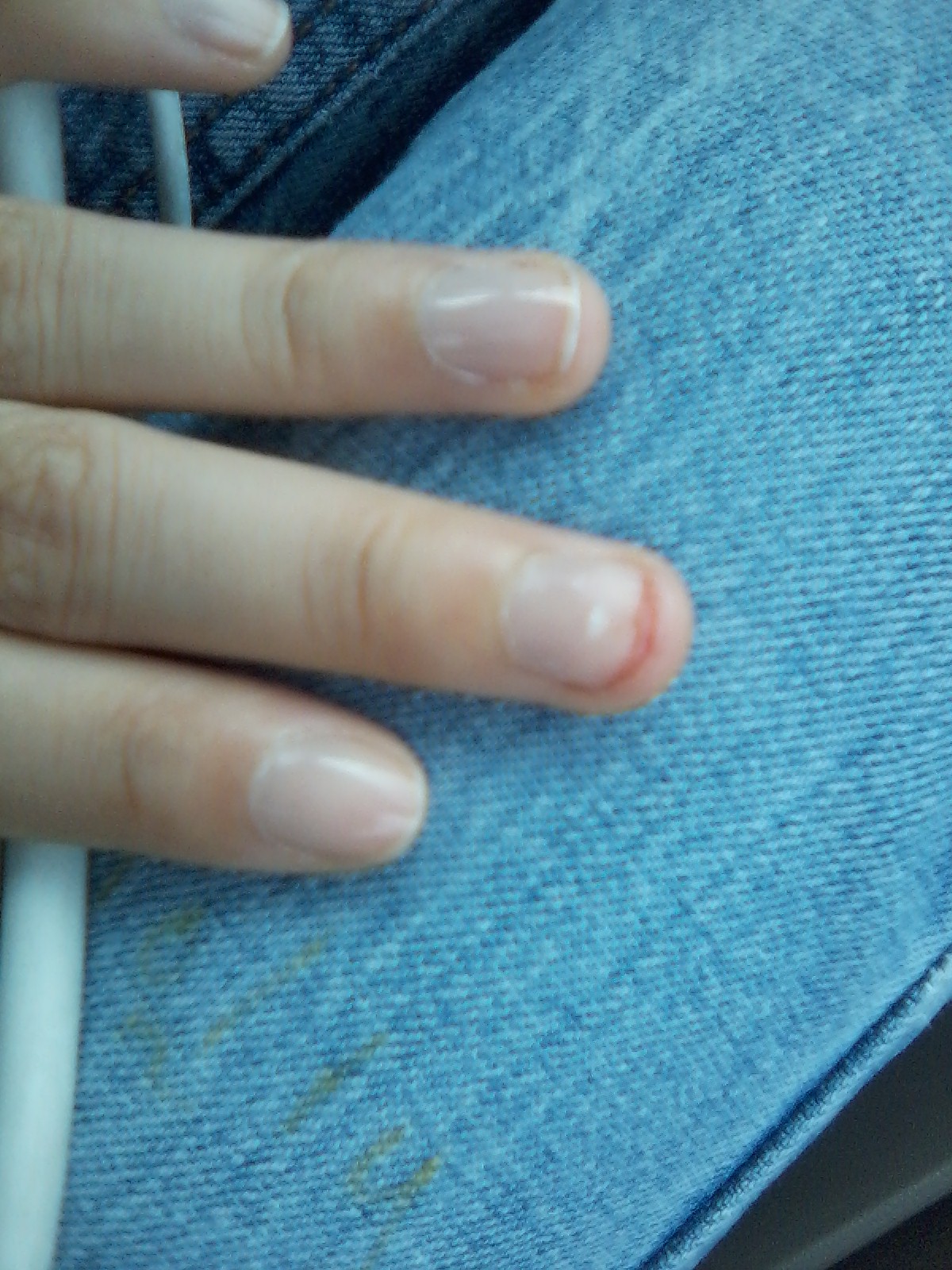 Dragon.Fly Torn my Nail!! OMG Blood!. + first aid care