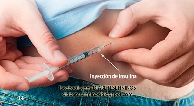 APLICACIÓN DE  LA INYECION DE INSULINA PARA DIABETICOS