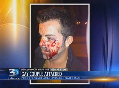 Two Women Brutally Attack Gay Couple For Being Gay Two Women Brutally Attack Gay Couple For Being Gay