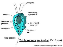 Prostatita cronica cu Trichomonas