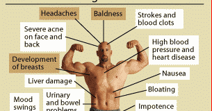 Steroids for bodybuilding side effects