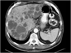 Hepatic System