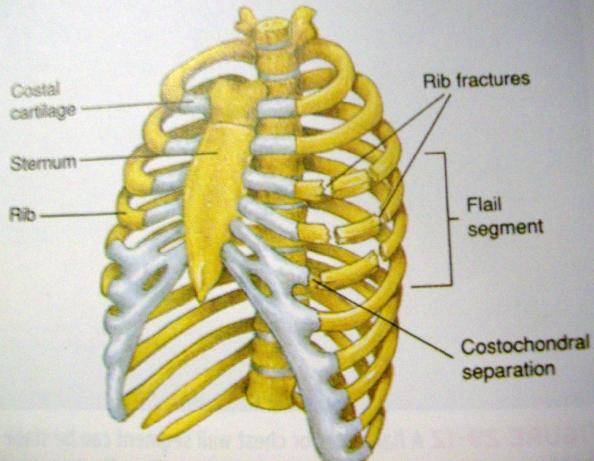 CVS ITHORACIC WALLS AND DIAPHRAGM GROUP D