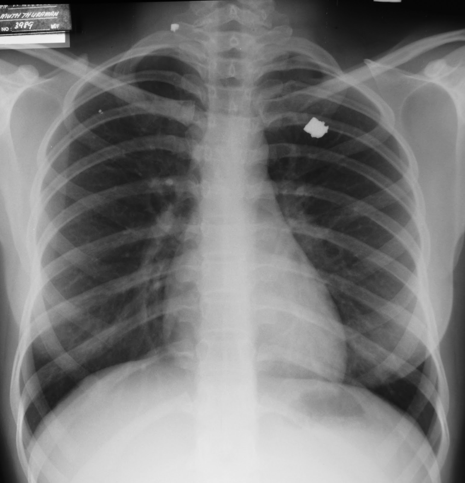 Albums 103+ Pictures Images Of X Rays Excellent 09/2023