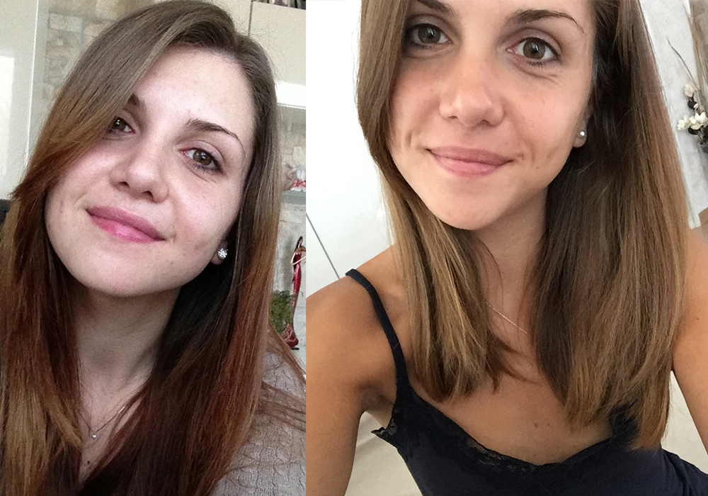 Biocosmesi Ecco Le Testimonianze Che Ti Cambieranno La Vita Foto Del Prima Dopo Verdebio Biocosmesi Ecco Le Testimonianze Che Ti Cambieranno La Vita Foto Del Prima Dopo Verdebio