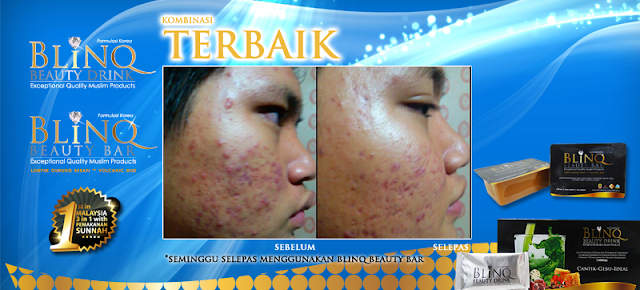 Testimoni Blinq Beauty Bar khasiat lumpur gunung berapi, khasiat kunyit cambodia, apple stem cell, sabun pencuci muka yang berkesan mengatasi masalah kulit, sabun pencuci muka yang jimat dan berkhasiat, produk blinq paling laris
