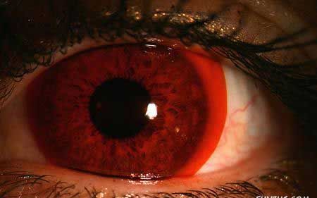 Modern & Stylish Eye Lenses Modern & Stylish Eye Lenses