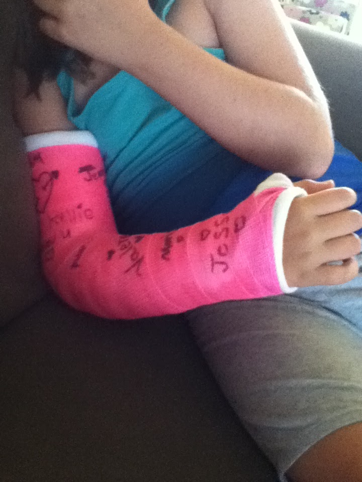 Arm With Cast