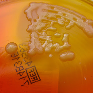 What Occurs When Probenecid Is Taken With Penicillin
