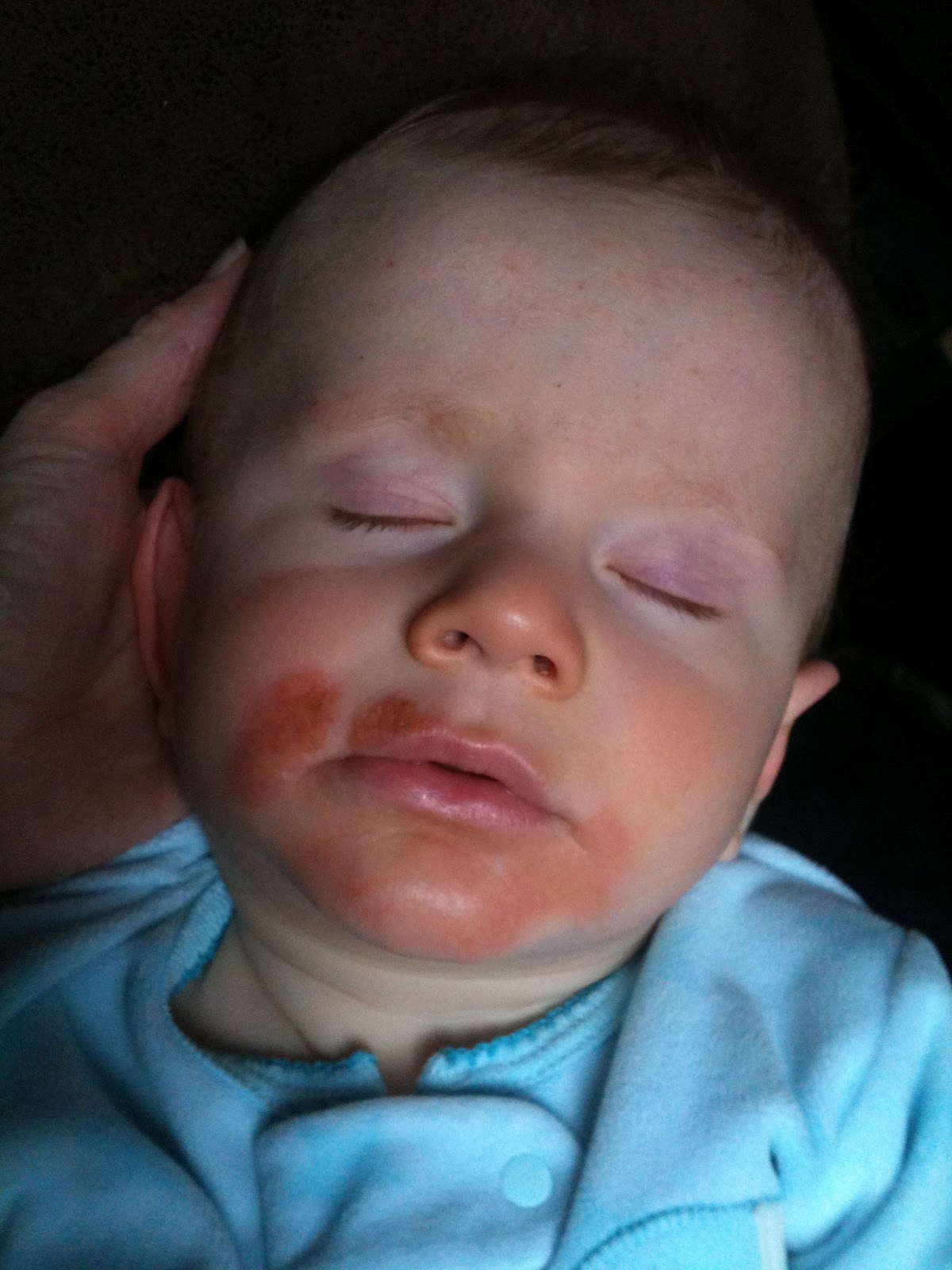 Autism Road to Recovery Food Allergies Xander's story