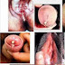 Obat Penyakit Gonore (GO) Ampuh Mengatasi Dalam 5 Hari thumbnail