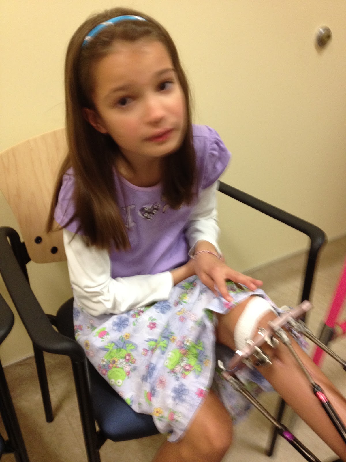 fibular hemimelia leg lengthening Whew! A "dent" vs. a break