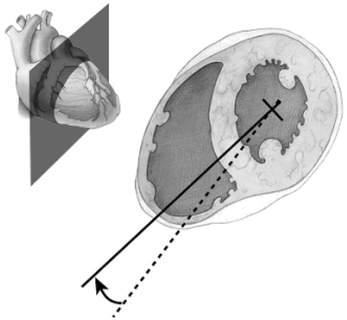 ct axis