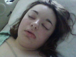 Right after surgery February 2, 2011